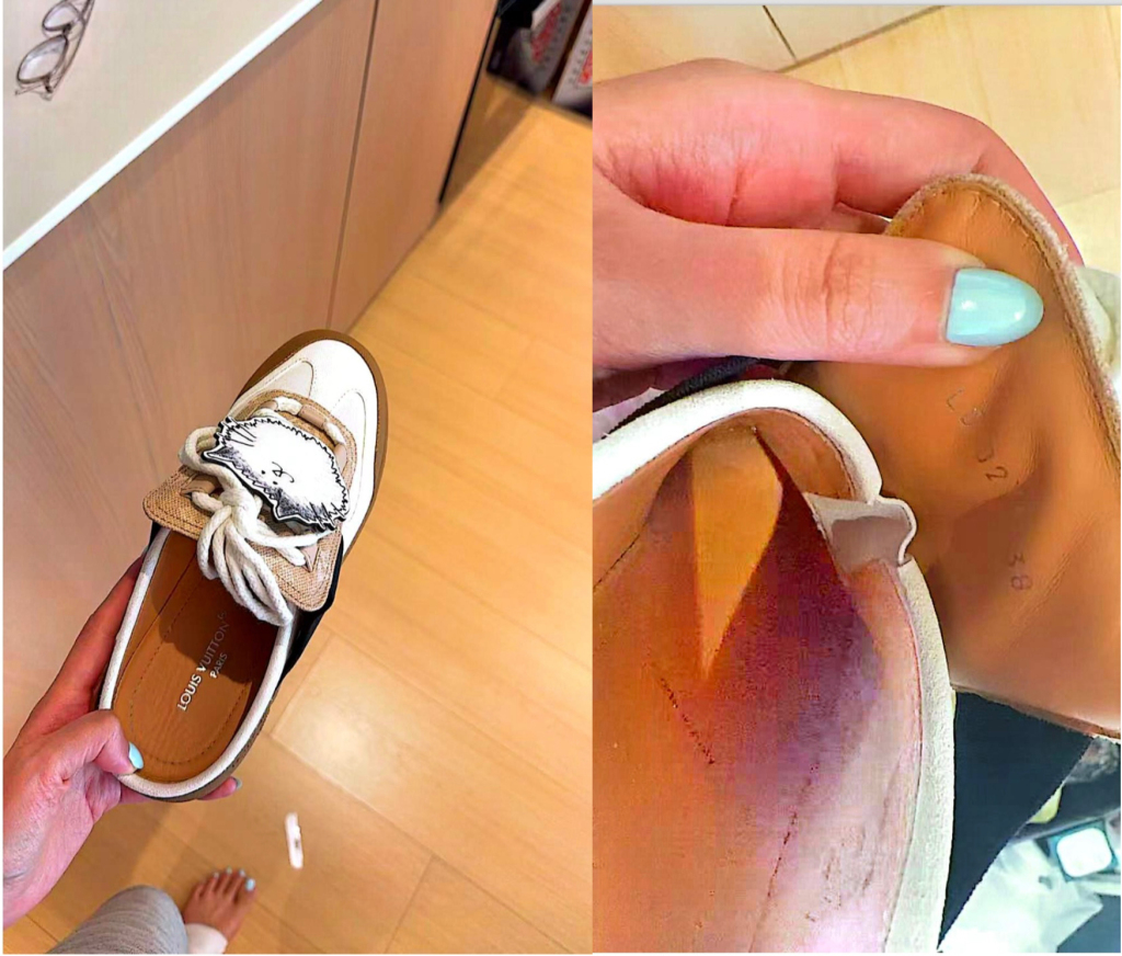 女子购近万元LV运动鞋穿后双脚多处破皮要求退款被拒，客服：不退，只能换(图3)