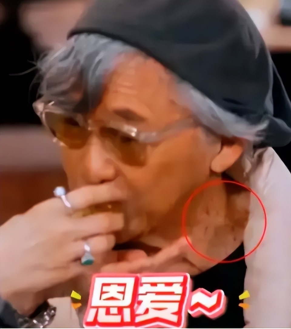 香港著名男星颈部现斑点，进食时眼神涣散，粉丝担心演唱会强度(图3)