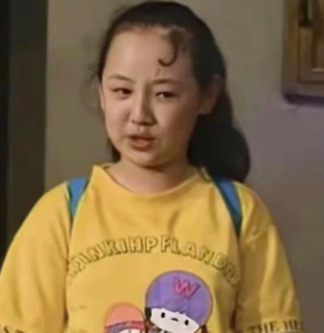 太无知！关凌硬挤儿子脸上痘，导致严重感染，做手术缝4针恐留疤(图3)