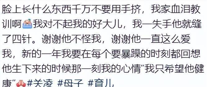 太无知！关凌硬挤儿子脸上痘，导致严重感染，做手术缝4针恐留疤(图30)