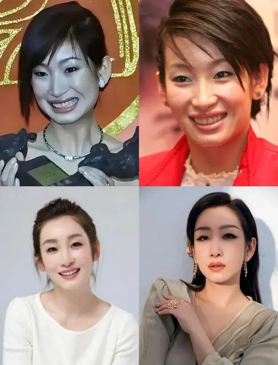 去掉滤镜后，秦海璐太秃然，殷桃像隔壁大婶子，宋祖英差点没认出(图8)