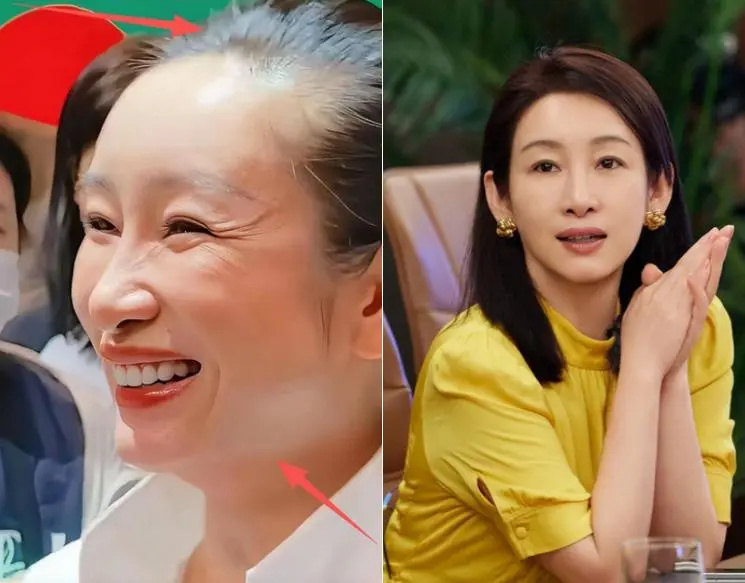 去掉滤镜后，秦海璐太秃然，殷桃像隔壁大婶子，宋祖英差点没认出(图10)