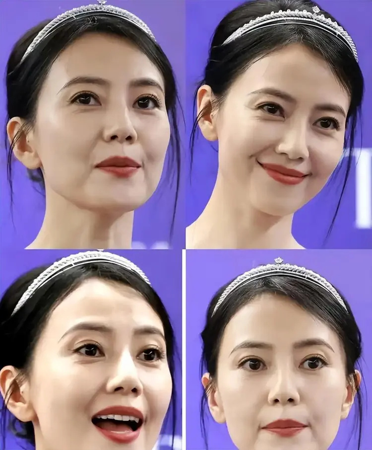 去掉滤镜后，秦海璐太秃然，殷桃像隔壁大婶子，宋祖英差点没认出(图40)