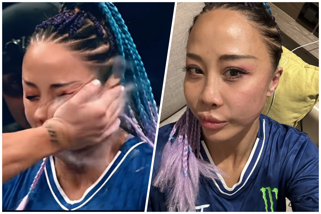 扇耳光大赛唯一中国女选手：我不疼(图1)