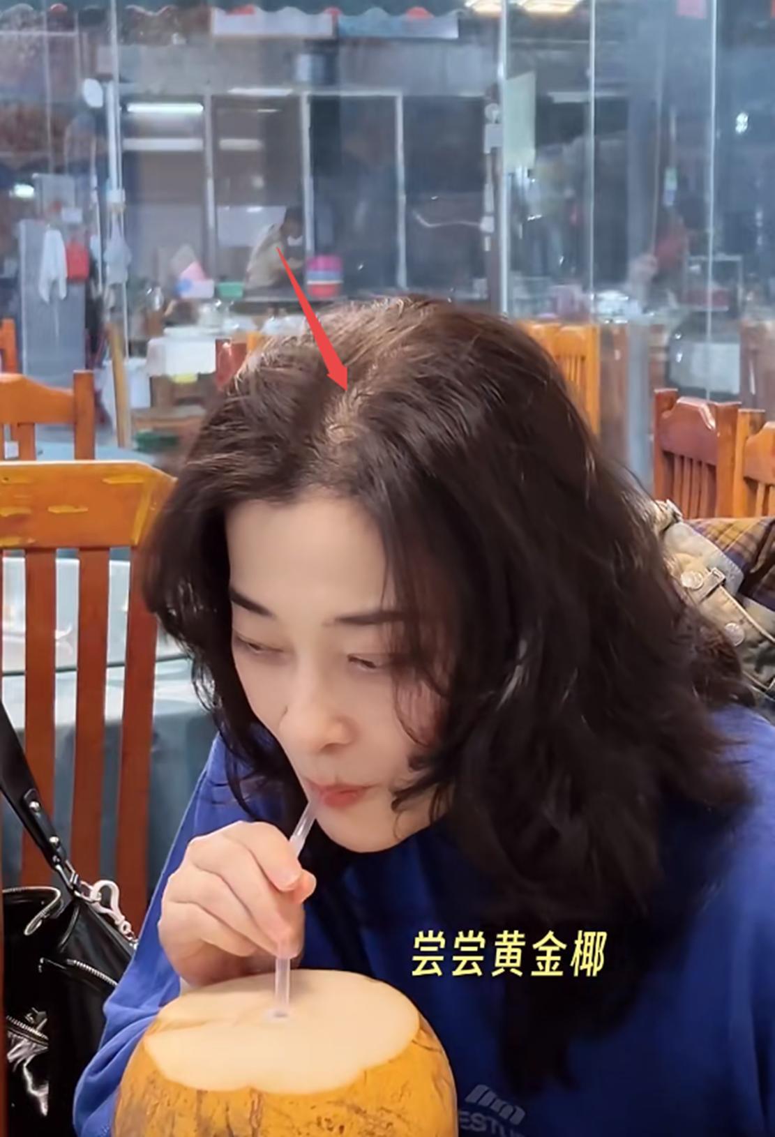 梅婷吃海鲜大排档，50了脸蛋很紧致，没做发型头顶稀疏发缝好宽(图5)