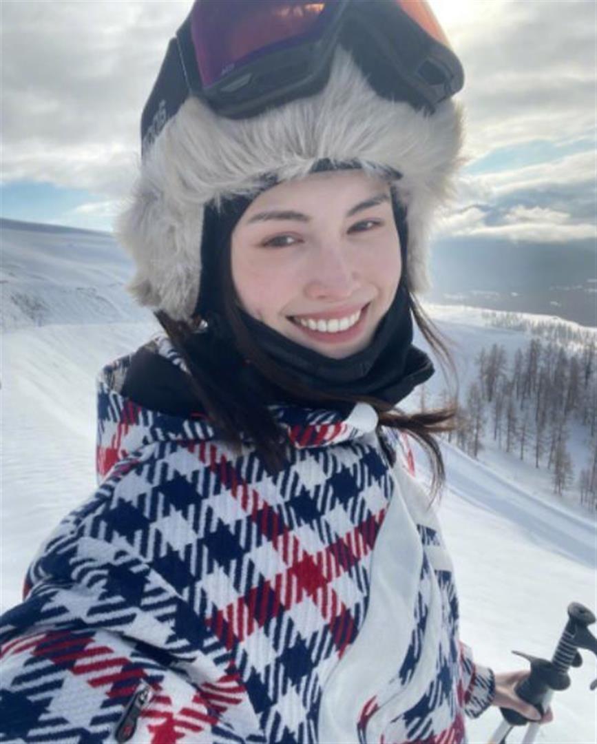 香港知名男星突然暴瘦，脸颊凹陷脖子前倾，与以往形象判若两人(图7)