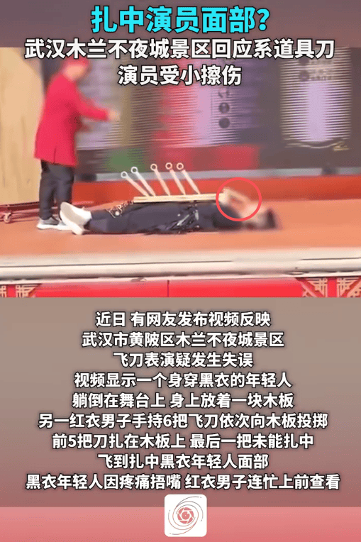 景区回应飞刀表演失误扎中演员面部：仅有一点擦伤，无大碍(图1)
