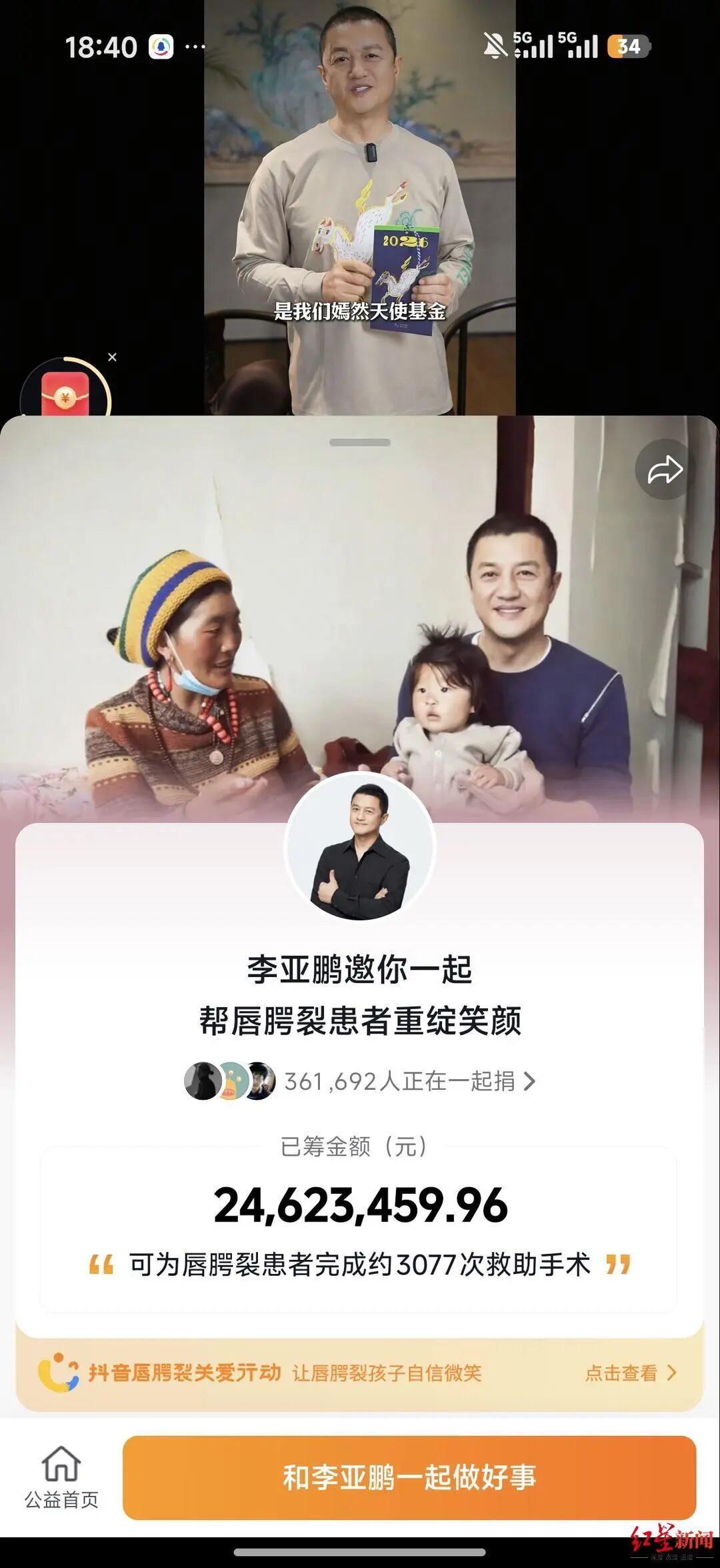 李亚鹏：近期直播共提现29万，已全部以网友名义捐赠给嫣然医院(图3)