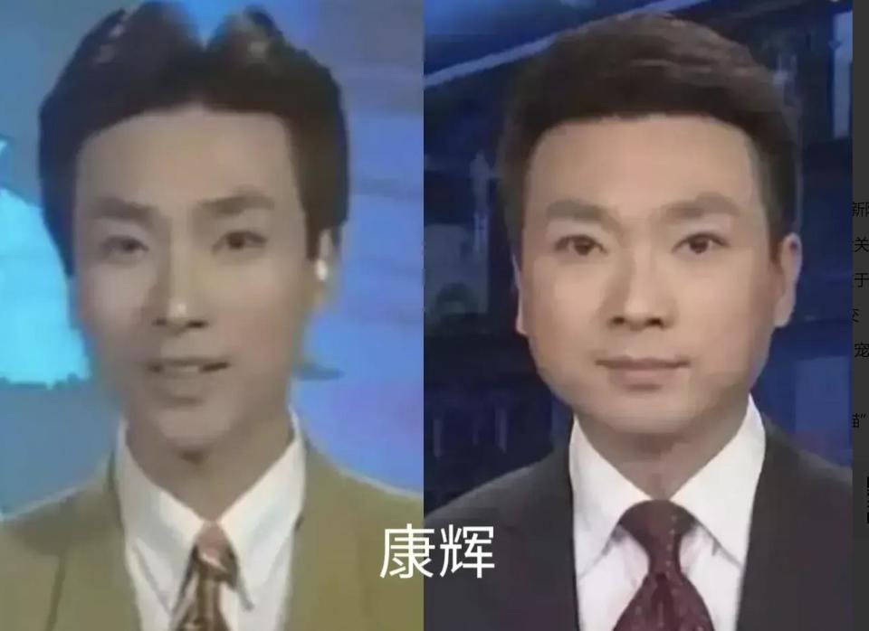 美貌的天敌不是发福而是发腮！从林青霞到刘亦菲都因发腮颜值暴跌(图46)