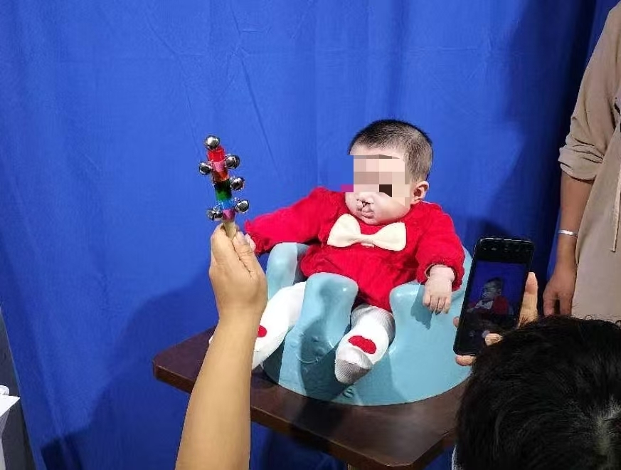 李亚鹏拼命要救的唇腭裂患者们：我很渴望和人正常说话(图2)