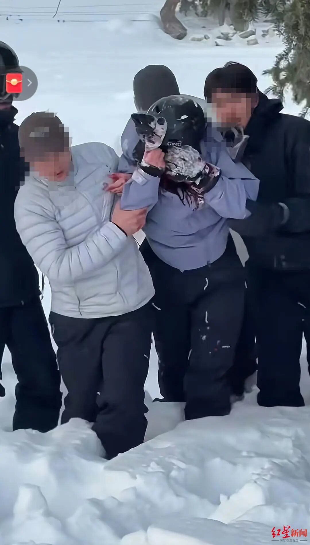 被雪豹咬伤女子已从急诊转至其他科室，目击者称“当事人没有去摸豹子”，村支书发声(图1)