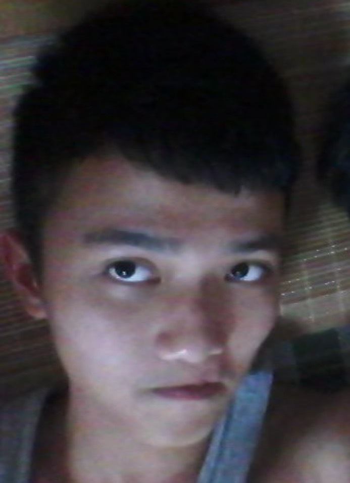 唇腭裂患者漫长的人生“修复”(图5)