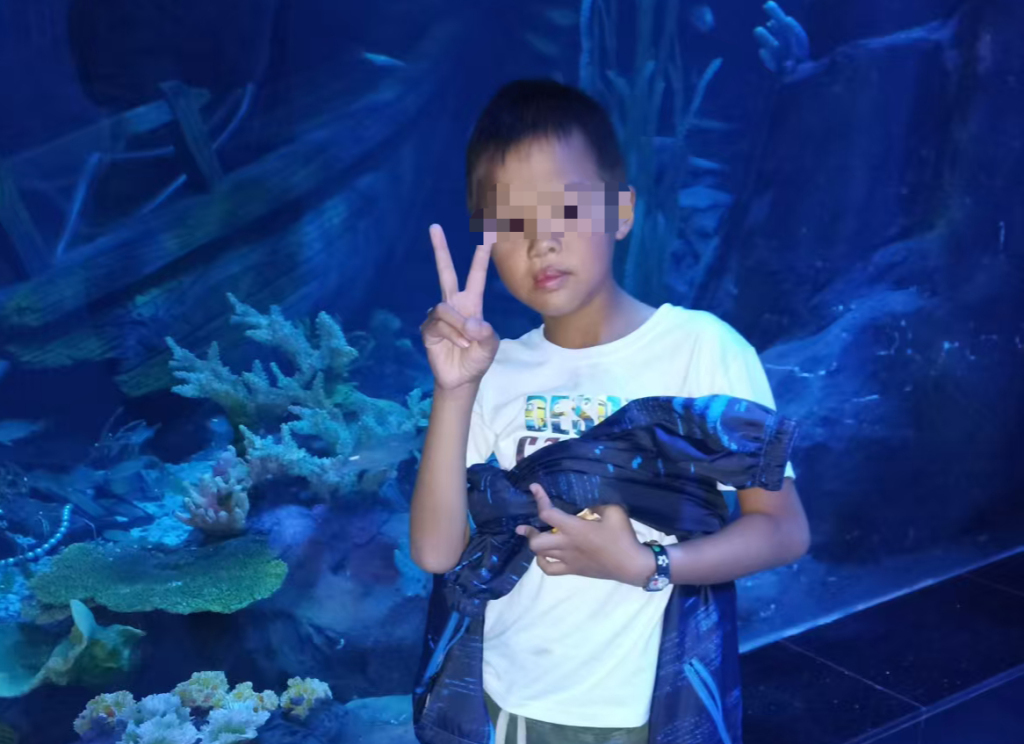 唇腭裂患者漫长的人生“修复”(图4)