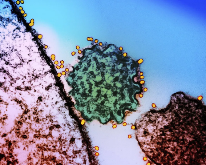 尼帕病毒病死率超40%？专家：无需恐慌(图1)