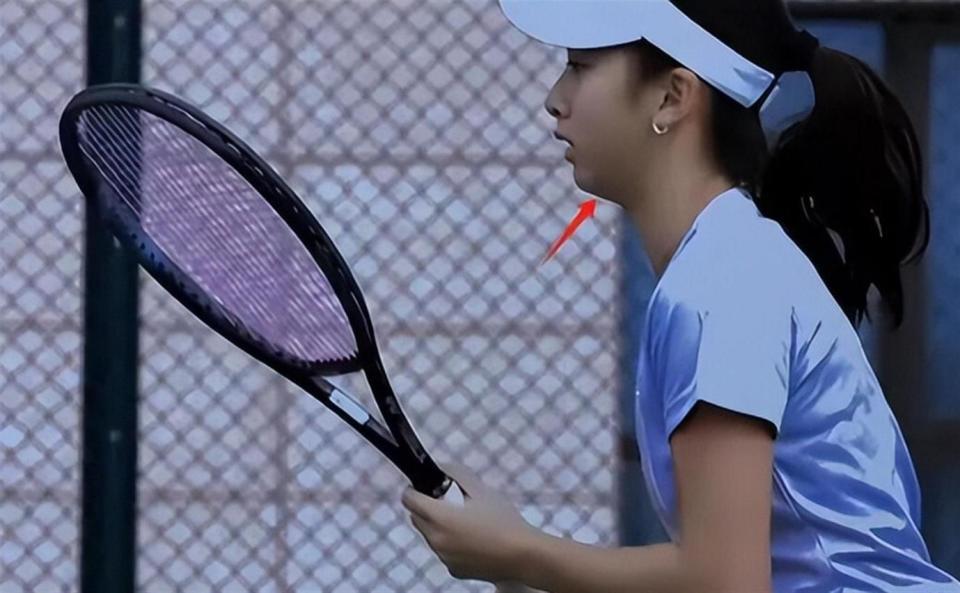 叶一茜晒出与森碟同框照，力破重男轻女的传闻，森碟下巴已矫正(图17)