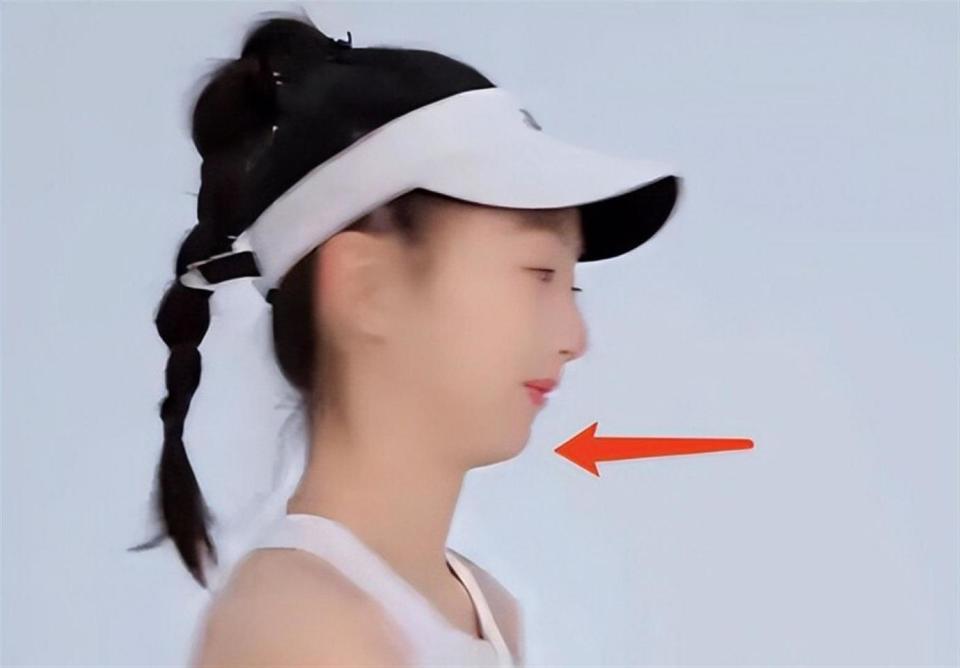 叶一茜晒出与森碟同框照，力破重男轻女的传闻，森碟下巴已矫正(图22)