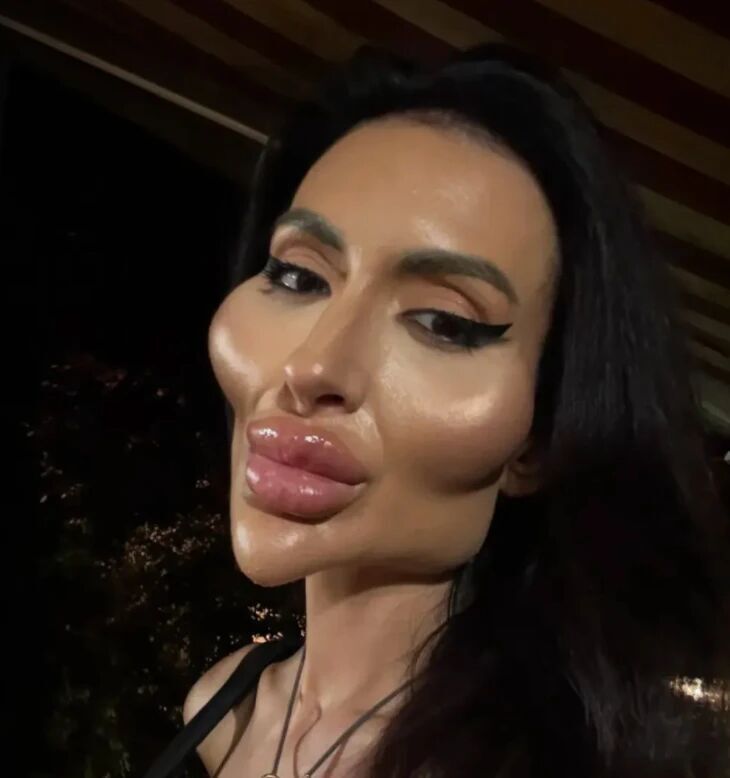 女网红为流量走极端路线，把自己整容成怪物，整容前照片被曝光(图1)