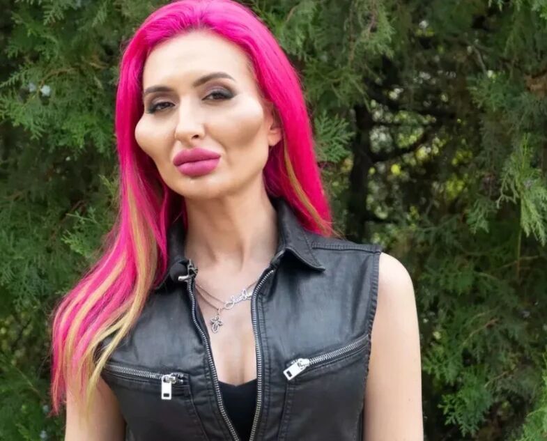 女网红为流量走极端路线，把自己整容成怪物，整容前照片被曝光(图2)