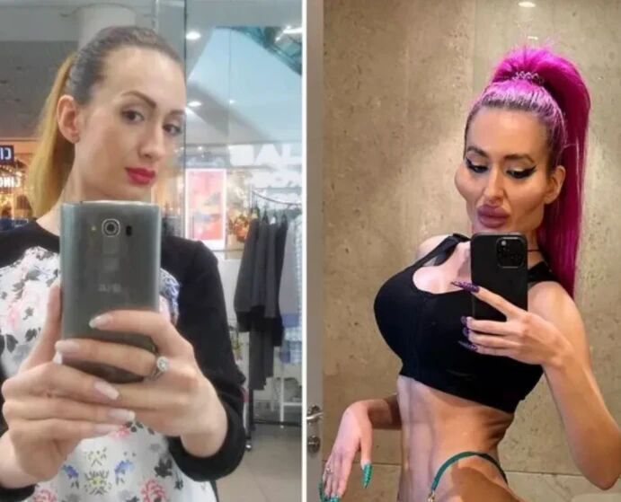 女网红为流量走极端路线，把自己整容成怪物，整容前照片被曝光(图3)